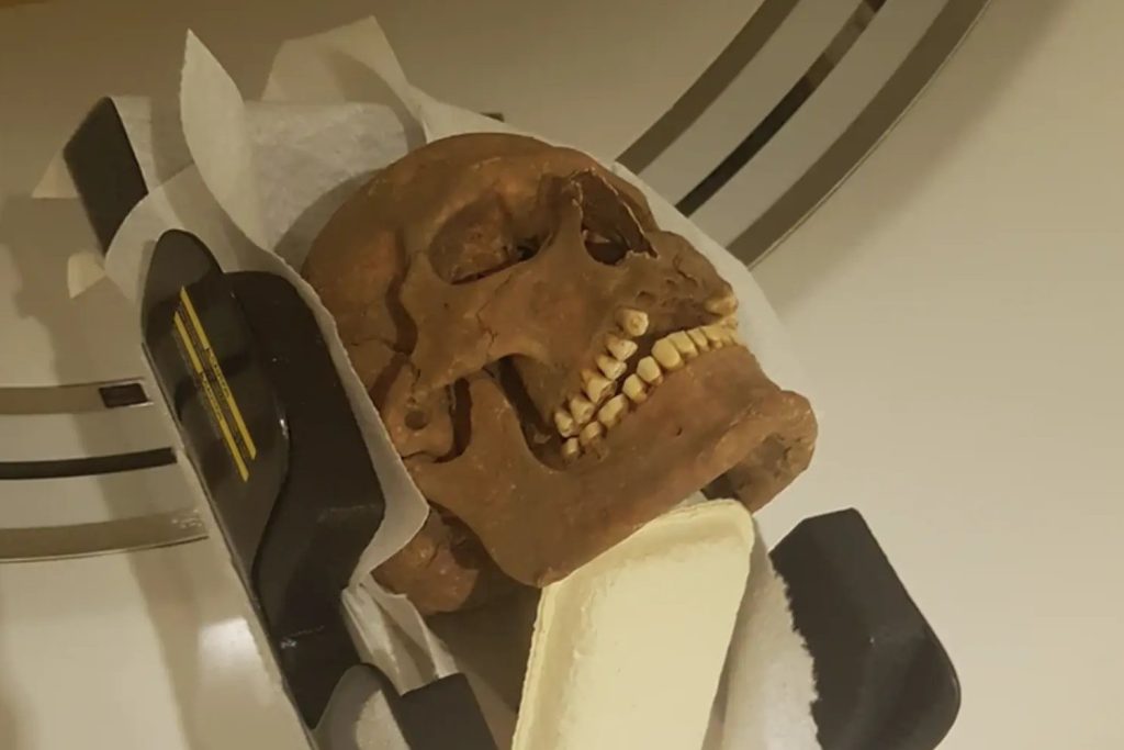 Image of a Viking skull undergoing a CT scan